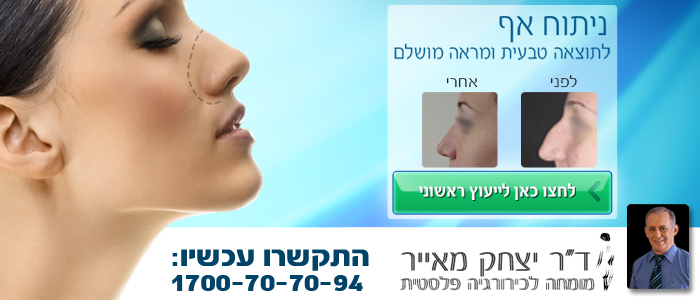 באנר פרסומי לד"ר יצחק מאייר